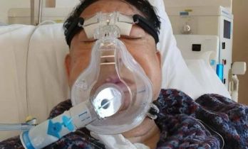 香港知名演员肾脏出问题，身材消瘦双颊凹陷，感激医生救命免破产